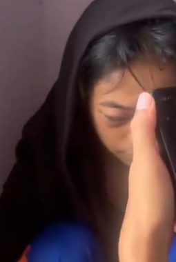 Viral! Siswi SMPN 12 Pematangsiantar Diduga Jadi Korban Bullying, Mata Lebam dan Bengkak